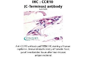 Image no. 1 for anti-Chemokine (C-C Motif) Receptor 10 (CCR10) (C-Term) antibody (ABIN1732758) (CCR10 抗体  (C-Term))