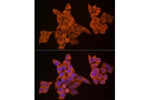 Immunofluorescence (IF) image for anti-Caspase 8 (CASP8) (AA 1-479) antibody (ABIN6137970)