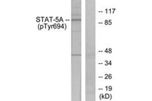 Western blot analysis of extracts from HeLa cells treated with EGF, using STAT5A (Phospho-Tyr694) Antibody. (STAT5A 抗体  (pTyr694))