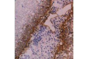 Immunohistochemistry (IHC) image for anti-Integrin beta 4 (ITGB4) antibody (ABIN2478034) (Integrin beta 4 抗体)