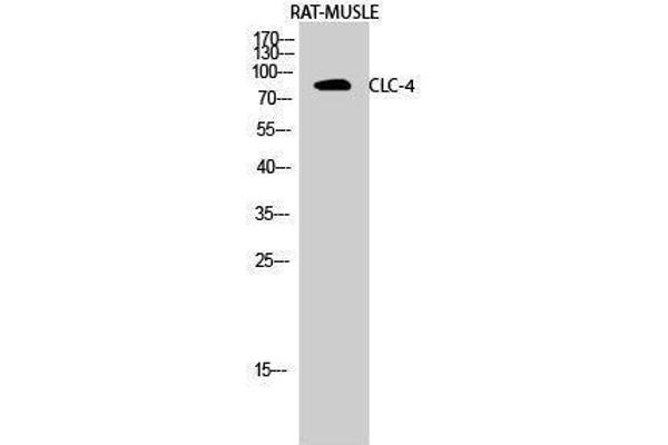 CLCN4 抗体  (Internal Region)