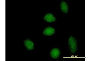 Immunofluorescence of purified MaxPab antibody to DNAJB6 on HeLa cell. (DNAJB6 抗体  (AA 1-326))