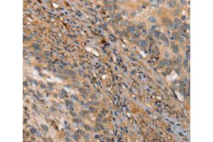 Immunohistochemistry (IHC) image for anti-Hexokinase 3 (White Cell) (HK3) antibody (ABIN2422847) (HK3 抗体)