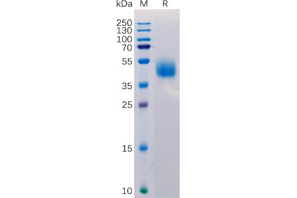 MICB Protein (AA 23-309) (His tag)