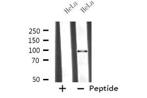 Western blot analysis of extracts from HeLa cells, using MASTL antibody. (MASTL 抗体  (C-Term))