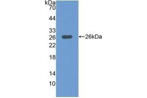 Detection of Recombinant MAP3K1, Human using Polyclonal Antibody to Mitogen Activated Protein Kinase Kinase Kinase 1 (MAP3K1) (MAP3K1 抗体  (AA 1307-1509))