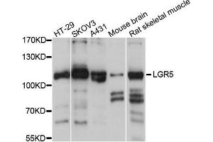 Western blot analysis of extracts of various cells, using LGR5 antibody. (LGR5 抗体)