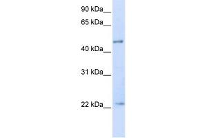 WB Suggested Anti-TRIM21 Antibody Titration:  0. (TRIM21 抗体  (N-Term))