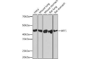 Western blot analysis of extracts of various cell lines, using WIF1 Rabbit mAb (ABIN7271383) at 1:1000 dilution. (WIF1 抗体)