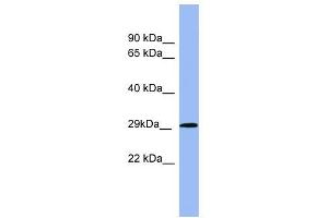 RAB5A antibody used at 1 ug/ml to detect target protein. (RAB5 抗体  (Middle Region))