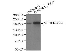 Western Blotting (WB) image for anti-Epidermal Growth Factor Receptor (EGFR) (pTyr1172) antibody (ABIN1870117) (EGFR 抗体  (pTyr1172))