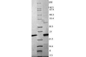 EBI-3 Mouse Recombinant Protein - SDS-PAGE. (EBI3 蛋白)