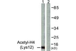 Western blot analysis of extracts from COS7 cells, treated with TSA 400nM 24h, using Histone H4 (Acetyl-Lys12) Antibody. (Histone H4 抗体  (acLys12))