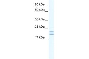 Western Blotting (WB) image for anti-Tubulin Polymerization Promoting Protein (Tppp) antibody (ABIN2461556) (Tppp 抗体)