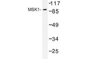 Image no. 1 for anti-Ribosomal Protein S6 Kinase, 90kDa, Polypeptide 5 (RPS6KA5) antibody (ABIN317778) (MSK1 抗体)