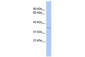 WB Suggested Anti-CLEC4G Antibody Titration: 0. (CLEC4G 抗体  (N-Term))