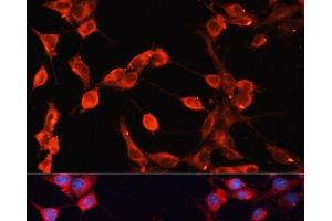 Immunofluorescence analysis of NIH-3T3 cells using ADAMTS13 Polyclonal Antibody at dilution of 1:100 (40x lens). (ADAMTS13 抗体)