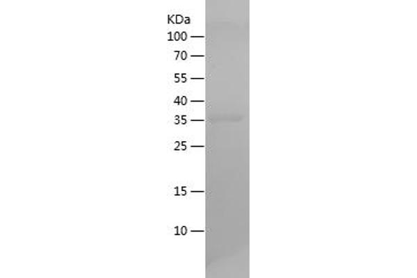 HSPE1 Protein (AA 1-102) (His-IF2DI Tag)