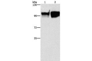 Western Blot analysis of Hela and raji cell using CD54 Polyclonal Antibody at dilution of 1:350 (ICAM1 抗体)