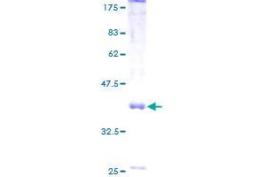 Image no. 1 for MRS2 Magnesium Homeostasis Factor Homolog (MRS2) (AA 1-117) protein (GST tag) (ABIN1311395) (MRS2 Protein (AA 1-117) (GST tag))