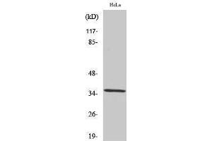 Western Blotting (WB) image for anti-Zinc Finger Protein 265 (Zranb2) (Internal Region) antibody (ABIN3177987) (ZNF265 抗体  (Internal Region))