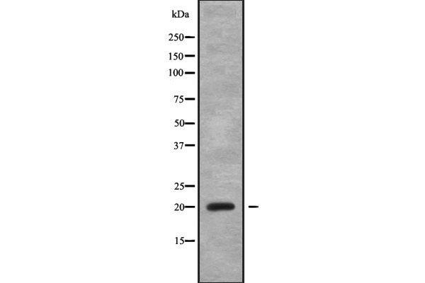 CABP5 抗体  (N-Term)