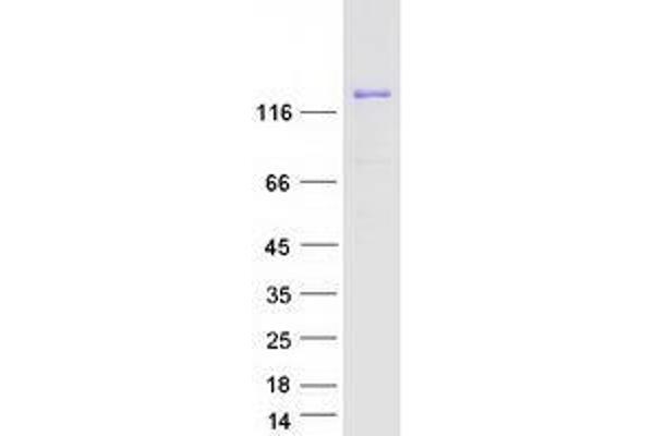 ULK4 Protein (Myc-DYKDDDDK Tag)