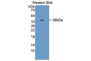 Western blot analysis of the recombinant protein. (Insulin Receptor 抗体  (AA 1114-1382))