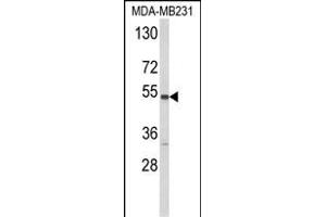 Western blot analysis of CYP2A13 Antibody (C-term) (ABIN652591 and ABIN2842396) in MDA-M cell line lysates (35 μg/lane). (CYP2A13 抗体  (C-Term))