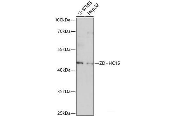 ZDHHC15 抗体