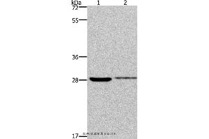 Western blot analysis of 231 and Hela cell, using CDK1 Polyclonal Antibody at dilution of 1:300 (CDK1 抗体)