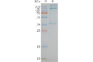 Human AD-Nanodisc, Flag Tag on SDS-PAGE (F4/80 蛋白)
