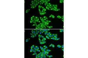 Immunofluorescence analysis of HeLa cells using DDX3X antibody. (DDX3X 抗体)