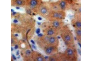 IHC-P analysis of Liver tissue, with DAB staining. (IFNA21 抗体  (AA 25-189))