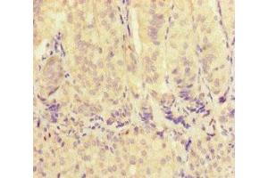 Immunohistochemistry of paraffin-embedded human adrenal gland tissue using ABIN7175563 at dilution of 1:100 (VDAC2 抗体  (AA 2-36))