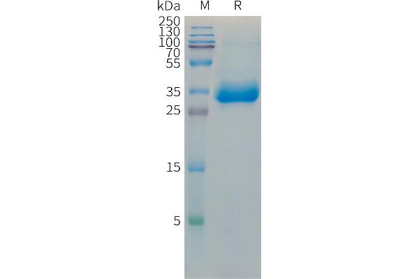 HIST1H1C Protein (Fc Tag)