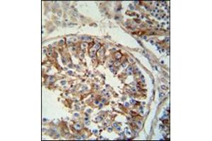 Immunohistochemistry analysis in Formalin Fixed, Paraffin Embedded Human testis tissue stained with SACA1 antibody (N-term) Cat. (SPACA1 抗体  (N-Term))