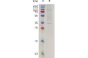 Human C Protein, hFc Tag on SDS-PAGE under reducing condition. (Claudin 2 Protein (CLDN2) (AA 29-78) (Fc Tag))