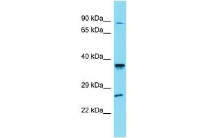 Western Blotting (WB) image for anti-Solute Carrier Family 35, Member G4 (SLC35G4) (N-Term) antibody (ABIN2505580) (SLC35G4 抗体  (N-Term))