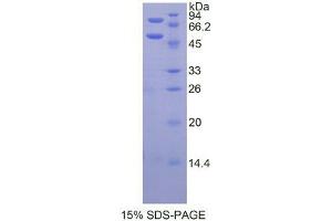 SDS-PAGE analysis of Mouse Protein C Protein. (PROC 蛋白)