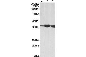 ABIN4902524 (1µg/ml) staining of Human (A), Mouse (B) and Rat (C) Skeletal Muscle lysates (35µg protein in RIPA buffer). (ALDOA 抗体)