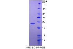 SDS-PAGE analysis of Mouse GDF2 Protein. (GDF2 蛋白)