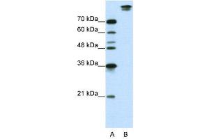 WB Suggested Anti-SF3B1  Antibody Titration: 0. (SF3B1 抗体  (N-Term))