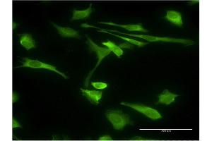 Immunofluorescence (IF) image for anti-Stress-Induced-phosphoprotein 1 (STIP1) (AA 1-543) antibody (ABIN524365)