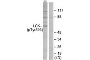 Western Blotting (WB) image for anti-Lymphocyte-Specific Protein tyrosine Kinase (LCK) (pTyr393) antibody (ABIN2888462) (LCK 抗体  (pTyr393))