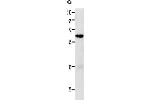Western Blotting (WB) image for anti-P21-Activated Kinase 1 (PAK1) antibody (ABIN2426800) (PAK1 抗体)