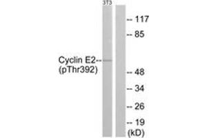 Western Blotting (WB) image for anti-Cyclin E2 (CCNE2) (AA 355-404), (pThr392) antibody (ABIN482177) (Cyclin E2 抗体  (pThr392))