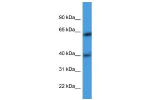 WB Suggested Anti-ARPM1 Antibody Titration: 0. (ARPM1 抗体  (N-Term))