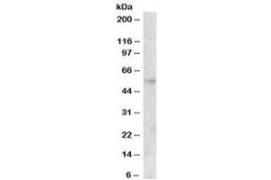 Western blot testing of HepG2 cell lysate with EGR2 antibody at 0. (EGR2 抗体)