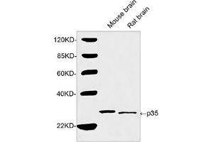 Western blot analysis of tissue lysates using 2 µg/mL Rabbit Anti-p35 Polyclonal Antibody (ABIN398903) The signal was developed with IRDyeTM 800 Conjugated Goat Anti-Rabbit IgG. (P35 (N-Term) 抗体)